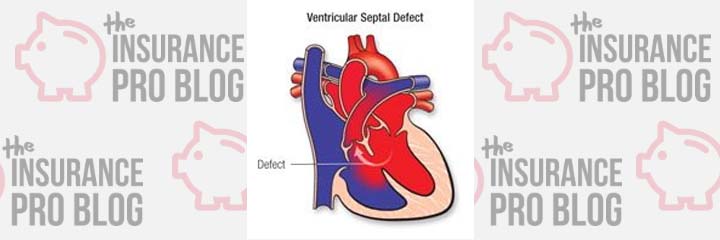 Applying for Life Insurance with a Ventricular Septal Defect