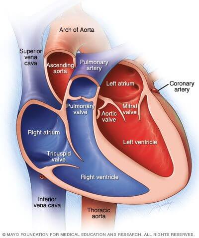 Life Insurance with Heart Murmur